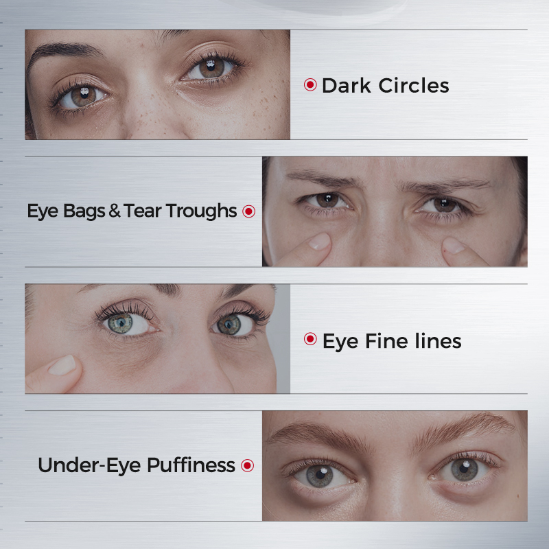 Eye Patches for Dark Circles – - Collagen Sheet Mask 评论和价格