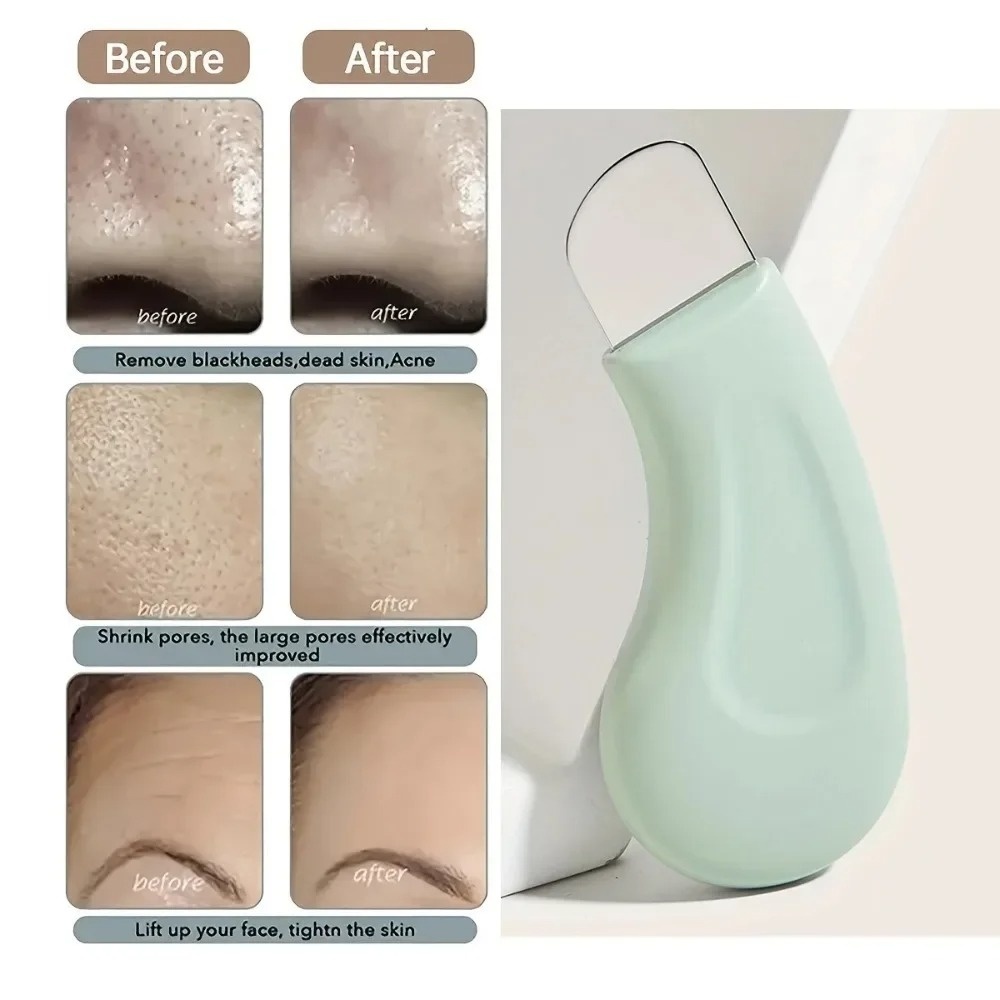 Deep Cleansing Blackhead White - Skincare Scora 评论和价格