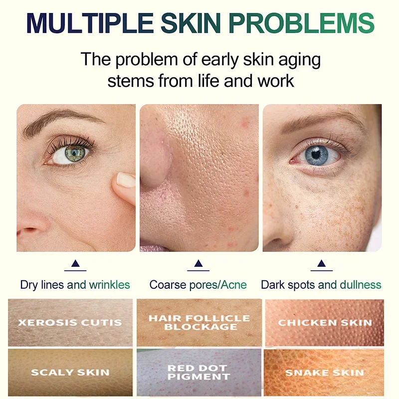 2ND Salicylic Acid Face Facial - Salicylic Acid Cleanser 评论和价格