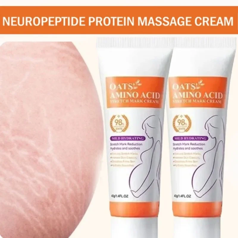Stretch Marks Permanent Remova - Skincare Oat 评论和价格