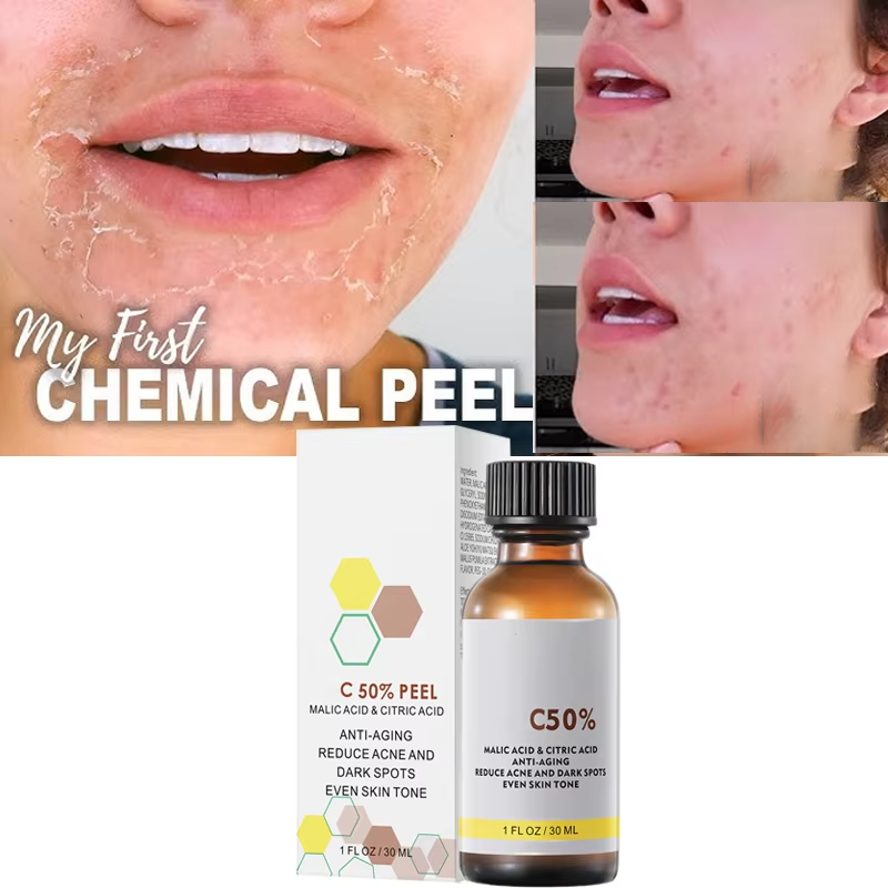 With Malic Acid And Citric Aci - Salicylic Acid Cleanser 评论和价格