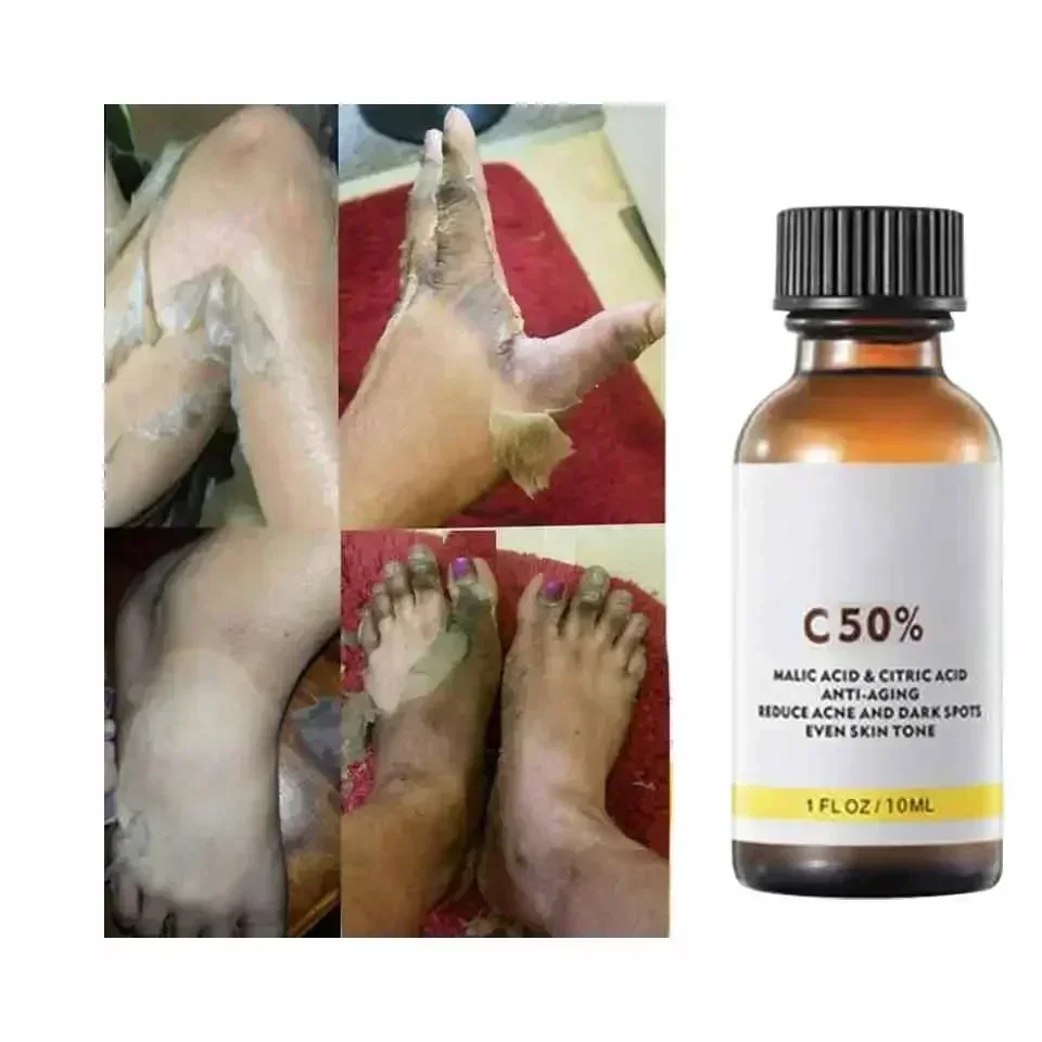 With Malic Acid And Citric Aci - Salicylic Acid Cleanser 评论和价格
