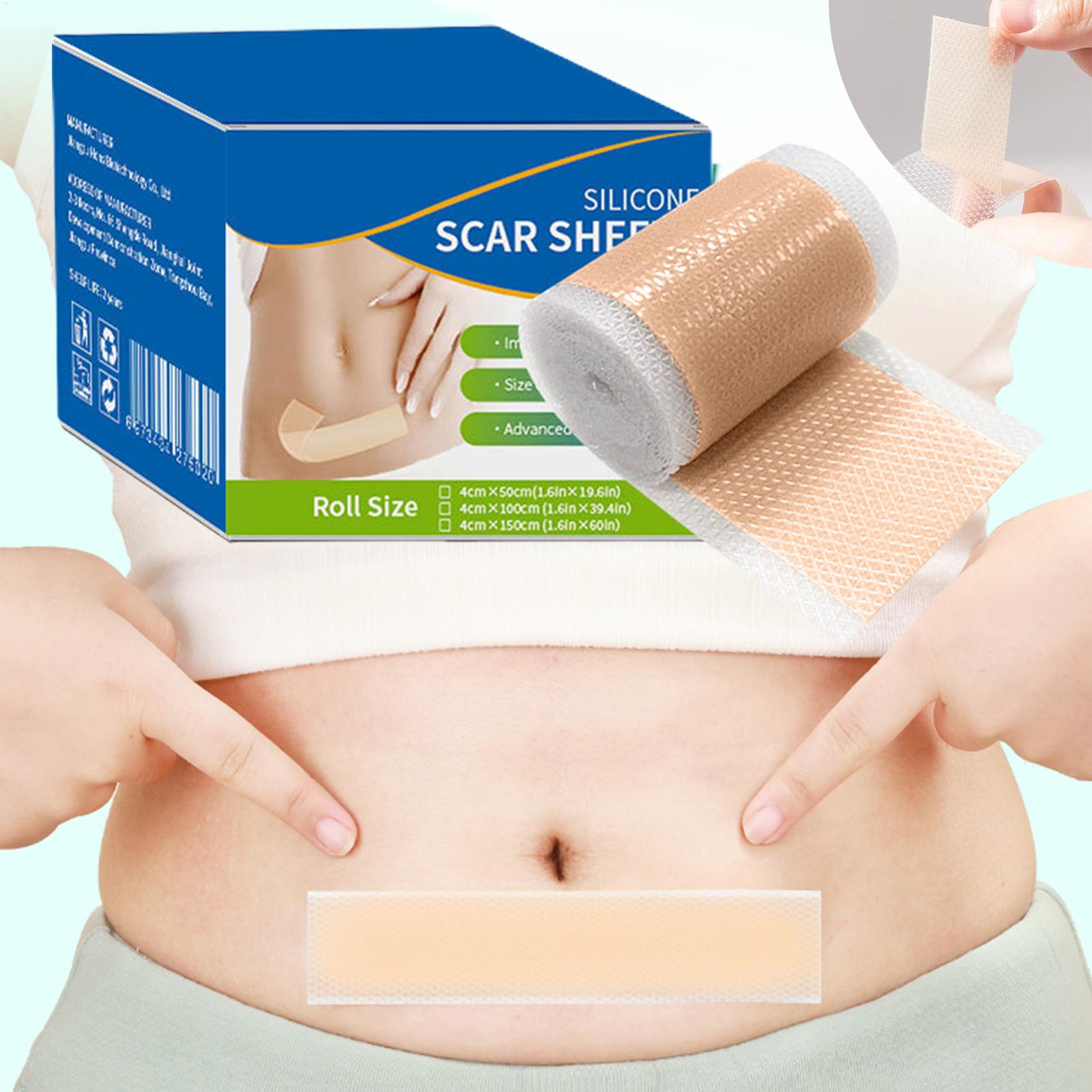 1 Roll Silicone Scar Sheets 4c - Collagen Sheet Mask 评论和价格